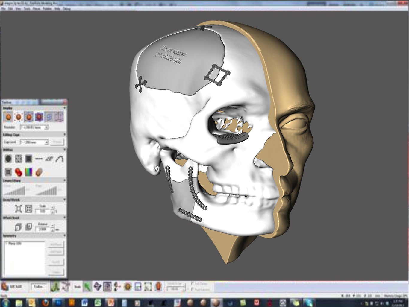 Medical Modeling with Geomagic software