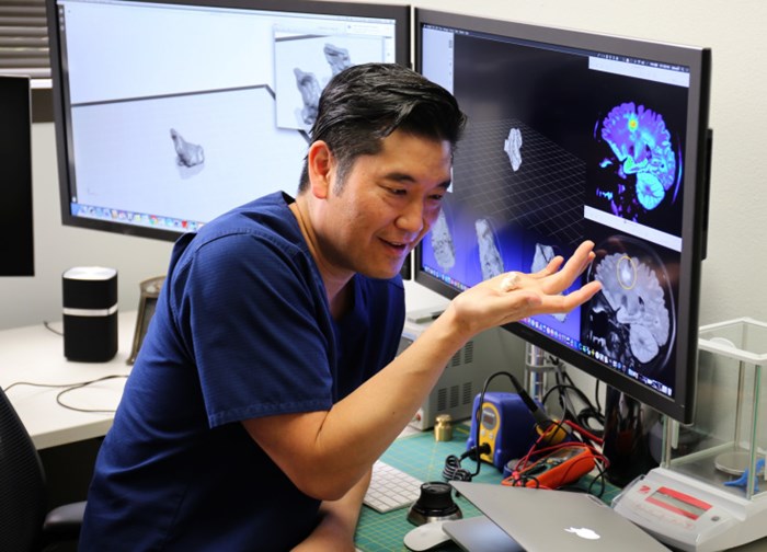 Médicos Começam a Usar Impressão 3D do Cérebro Para o Diagnóstico De Doenças 2