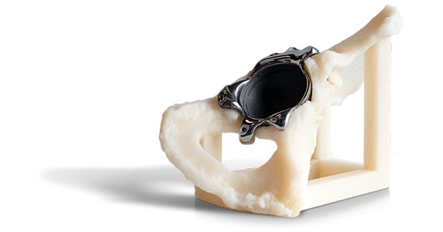 Impressão 3D na Medicina - Soluções para HealthCare 3